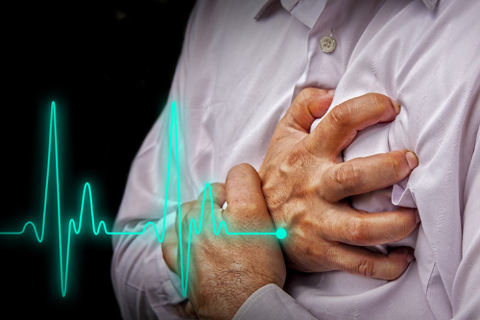 Men with chest pain - heart attack