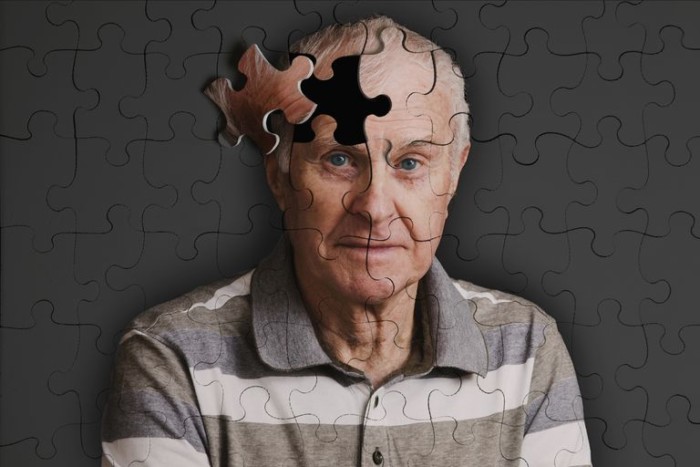 Dementia-Andrew-Bret-Wallis-585bdbdd3df78ce2c3fbf8c1