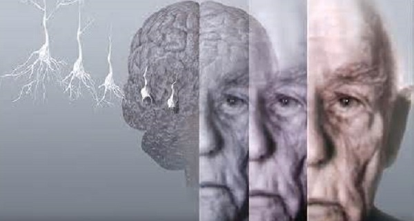 dementia1