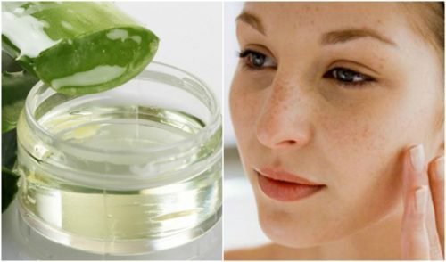 C-mo-hacer-un-gel-casero-para-disminuir-las-estr-as-cicatrices-y-manchas-500x294