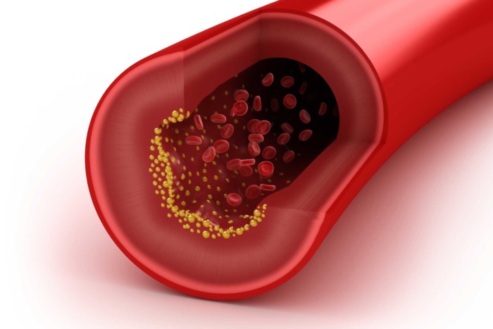 Why-blood-cholesterol-is-especially-important-if-you-have-diabetes