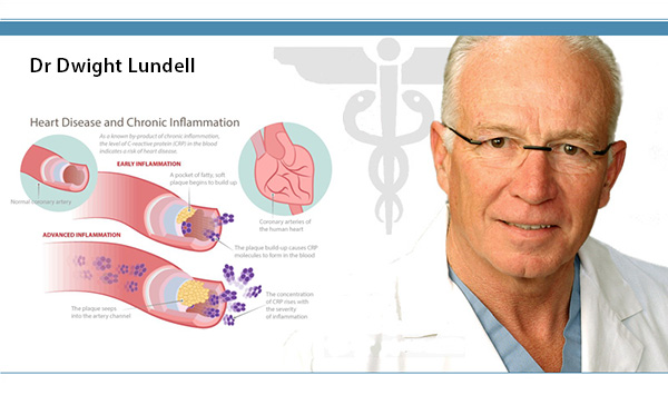 sante-cardiaque-crise-chirurgien-alimentation-lundell