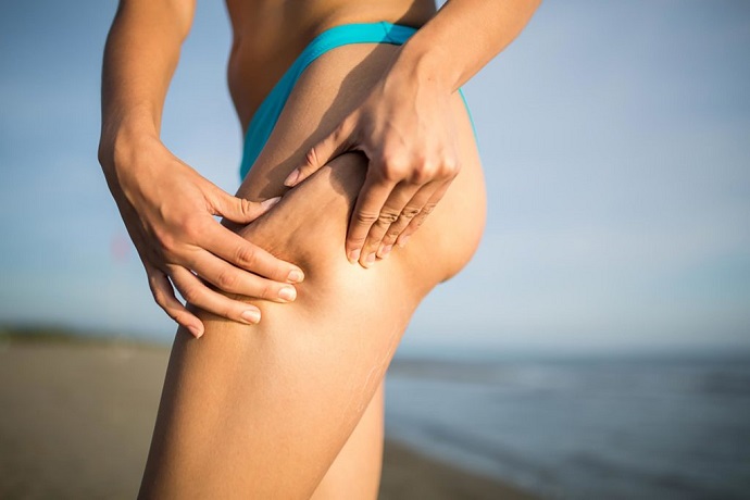 01_cellulite_Why-Is-Cellulite-So-Dang-Hard-to-Get-Rid-of-_380848234_eldar-nurkovic-1024x683