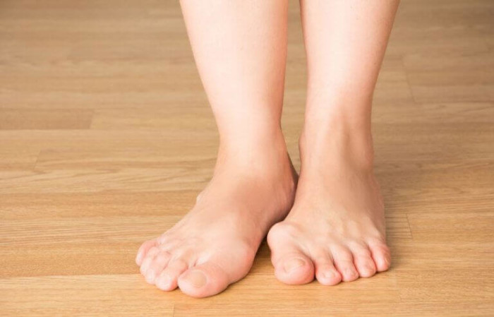 Bunion1