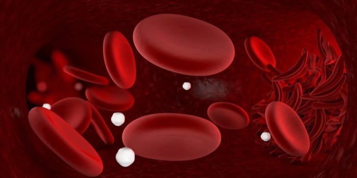 anemia-zasoby