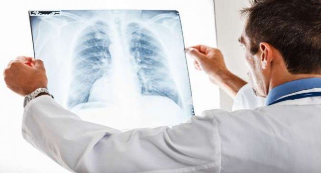 chest-X-ray-655x353
