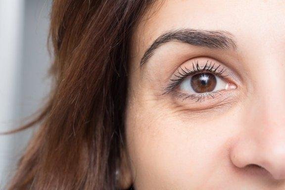 ojeras-bolsas-ojos-576x384-576x384