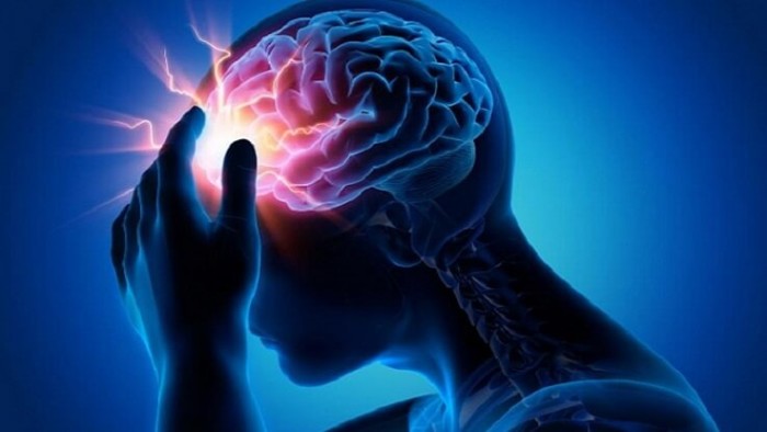 epilepsiya