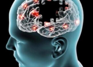 Деменція: лікар називає два поширені фактори схильності до недоумства