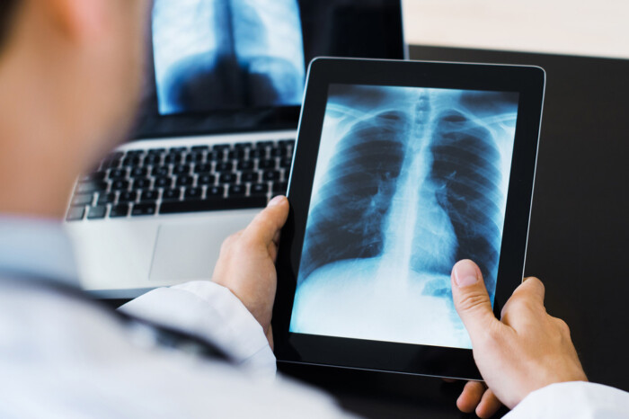 Doctor Using Digital Tablet Viewing Medical Scan